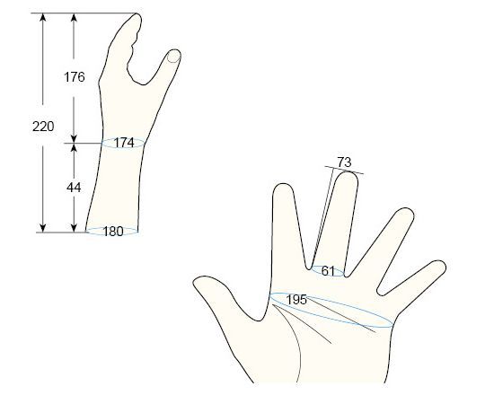 100 Female M left hand regal prosthesis