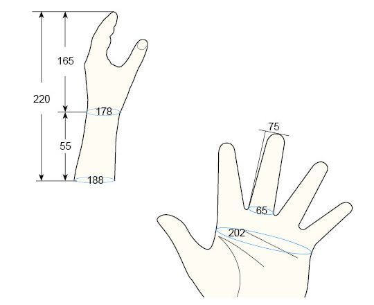 100 Male M left hand regal prosthesis