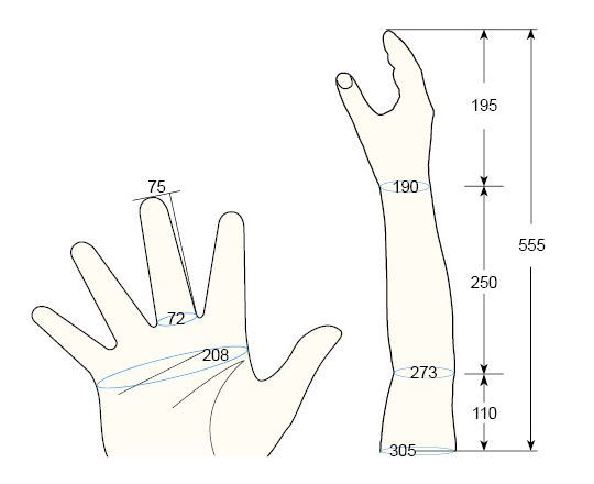 100 L Male L right hand regal prosthesis