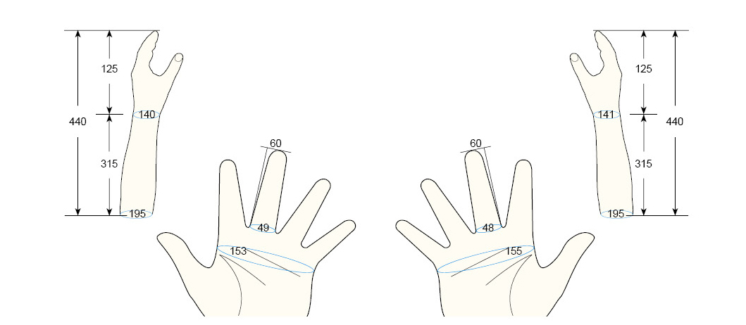 100 PL PM regal prosthesis