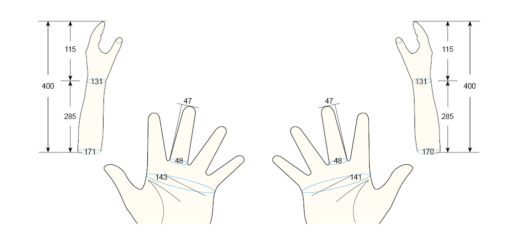 100 PL PS regal prosthesis