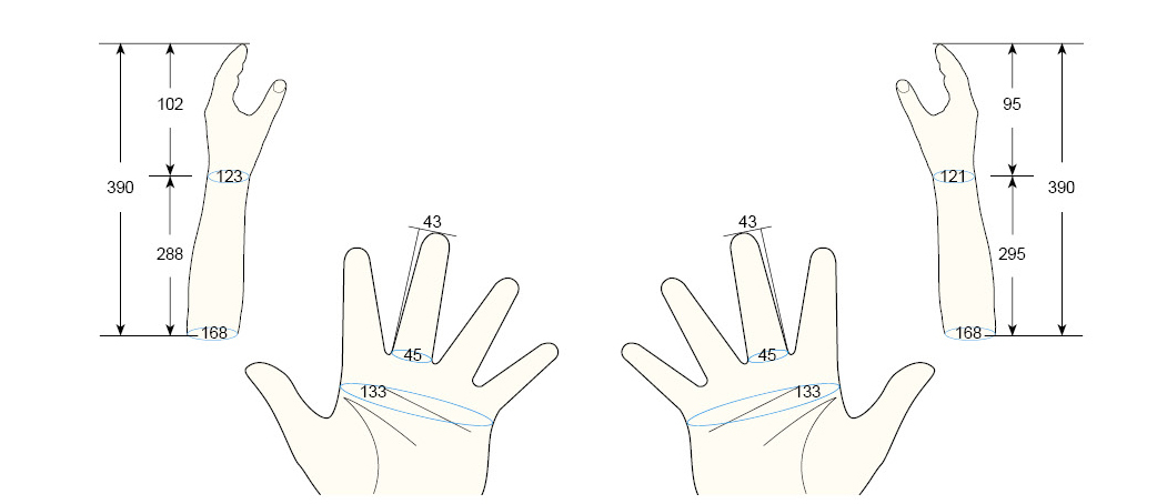 100 PL PXS regal prosthesis