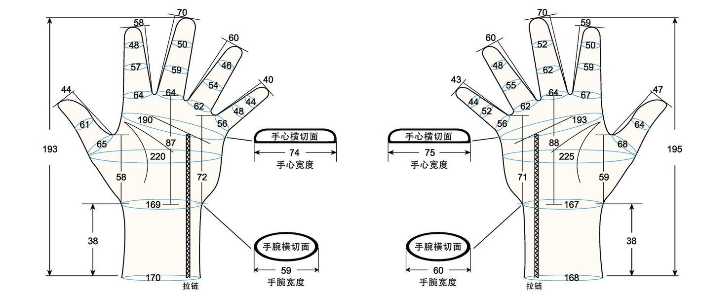 103 female adult MS measure sc regal prosthesis