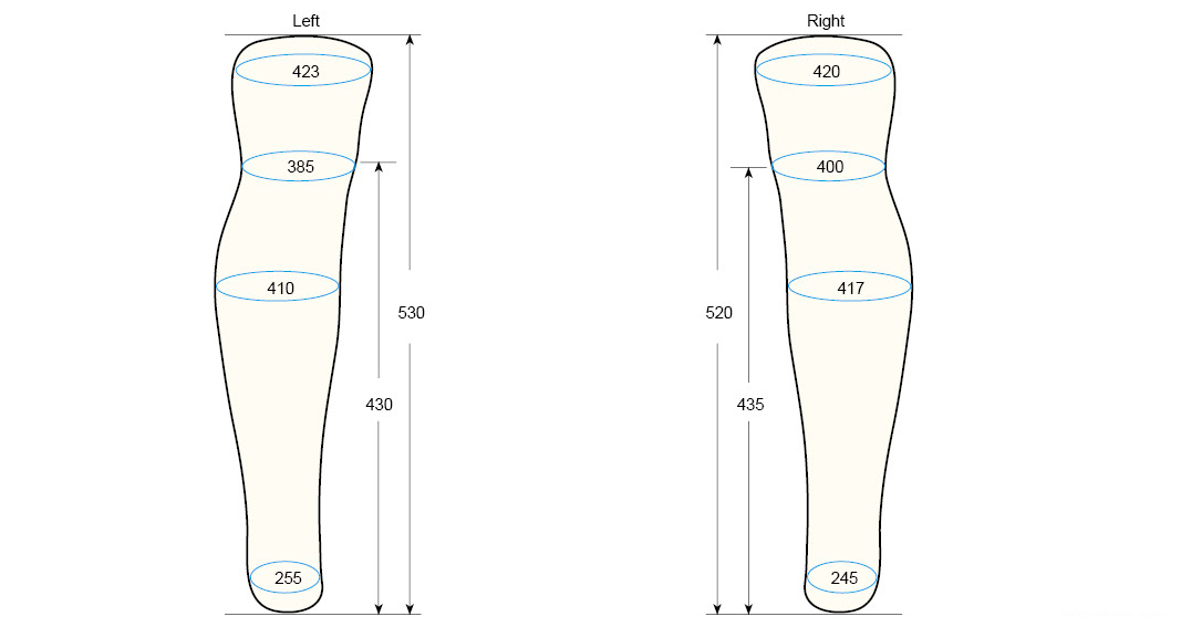 BKSL L measurement regal prosthesis