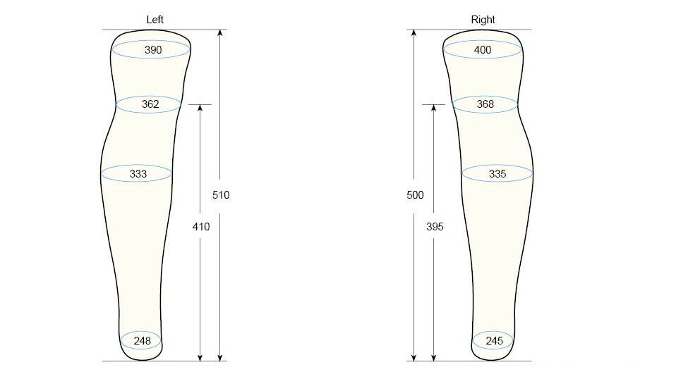 BKSL M measurement regal prosthesis
