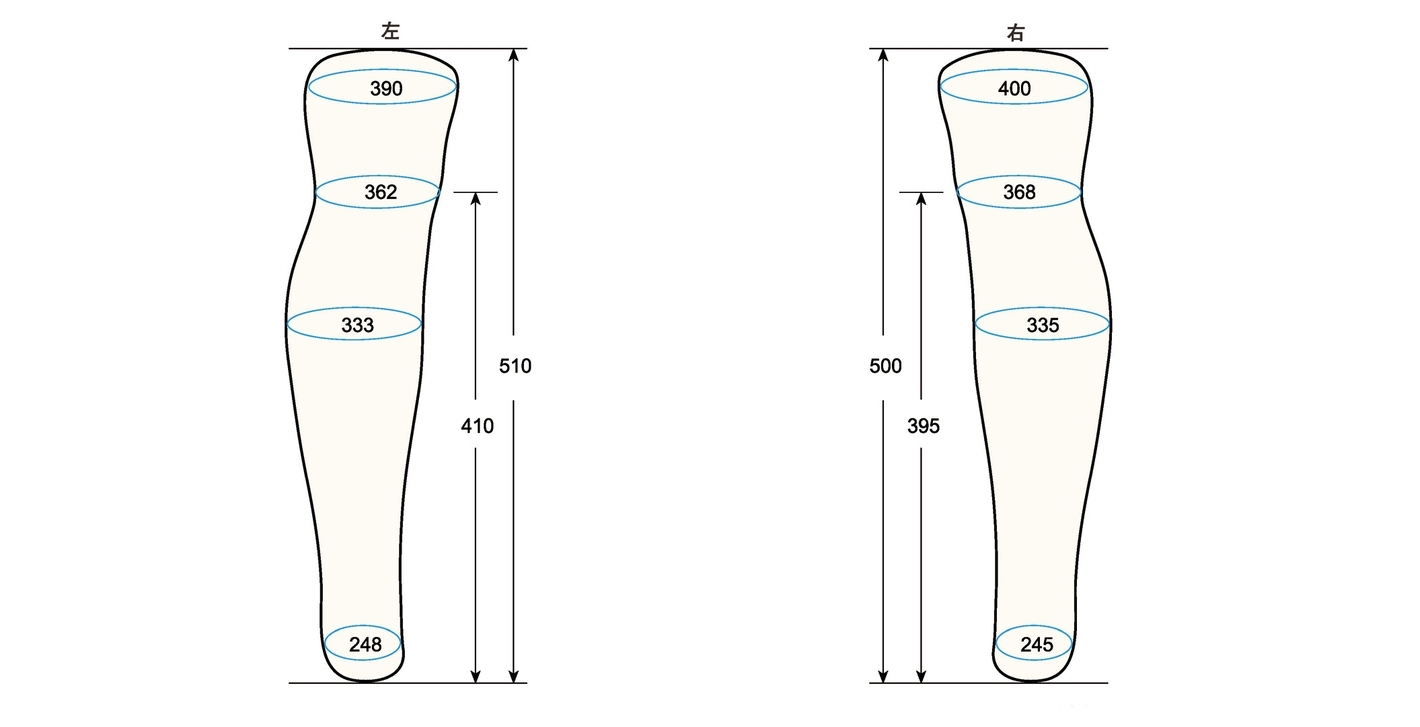 BKSL M measurement sc regal prosthesis