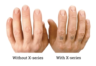 X Series